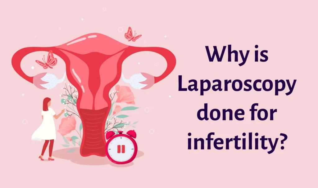 Why is Laparoscopy Done For Fertility