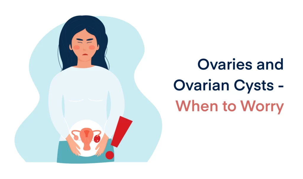 Ovaries and Ovarian Cysts When to Worry