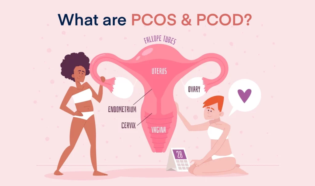 What are PCOS and PCOD