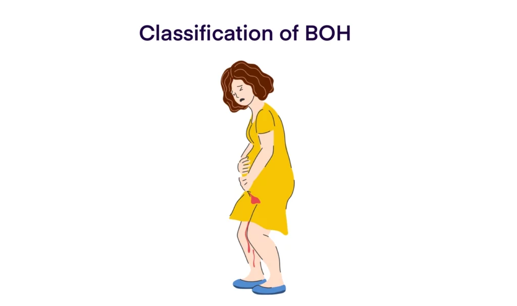 Classification of BOH