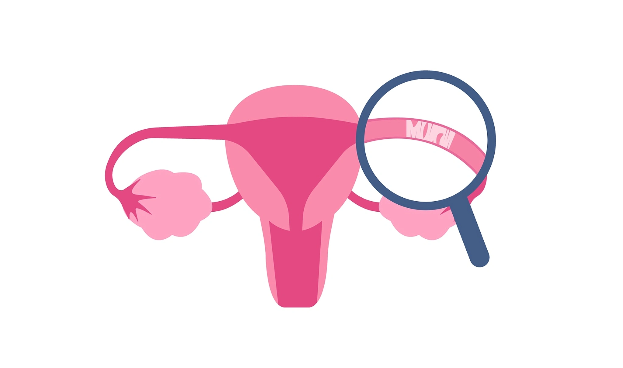 Fallopian Tube Blockage - Reason, Test, Treatment - Grace Fertility