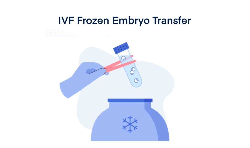 IVF Frozen Embryo Transfer