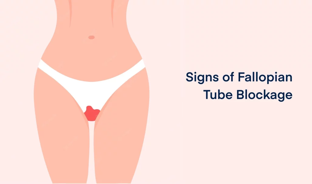Signs of Fallopian Tube Blockage