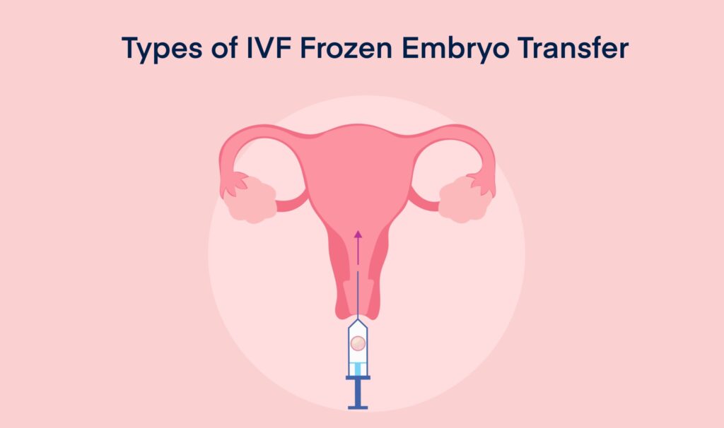 Types of IVF Frozen Embryo Transfer