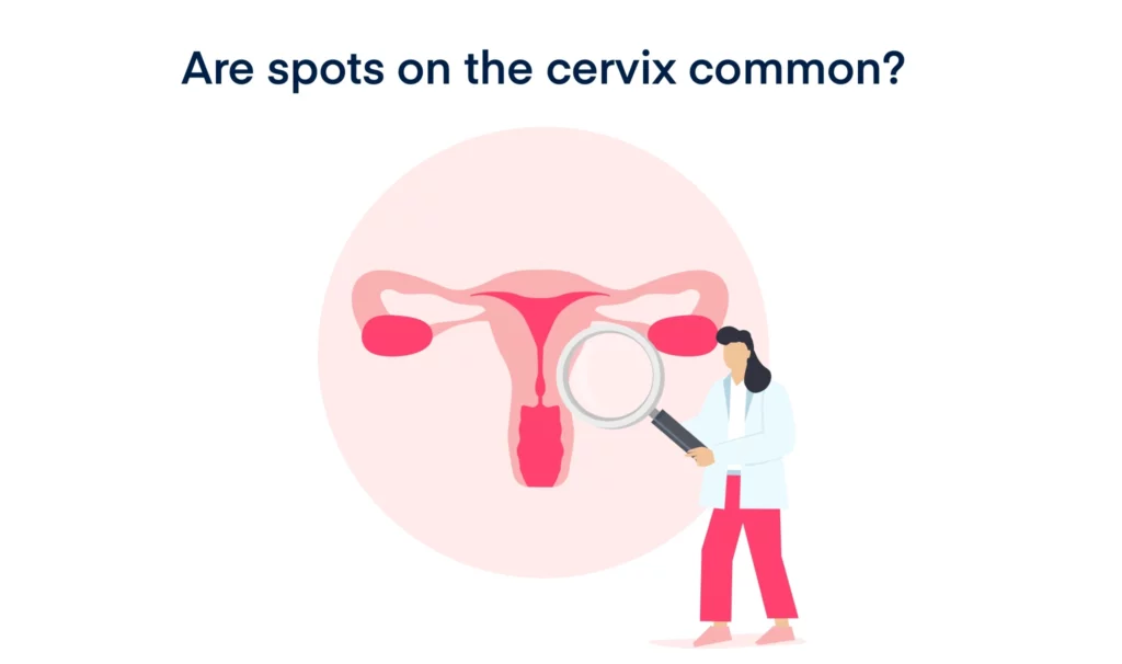 Are spots on the cervix common
