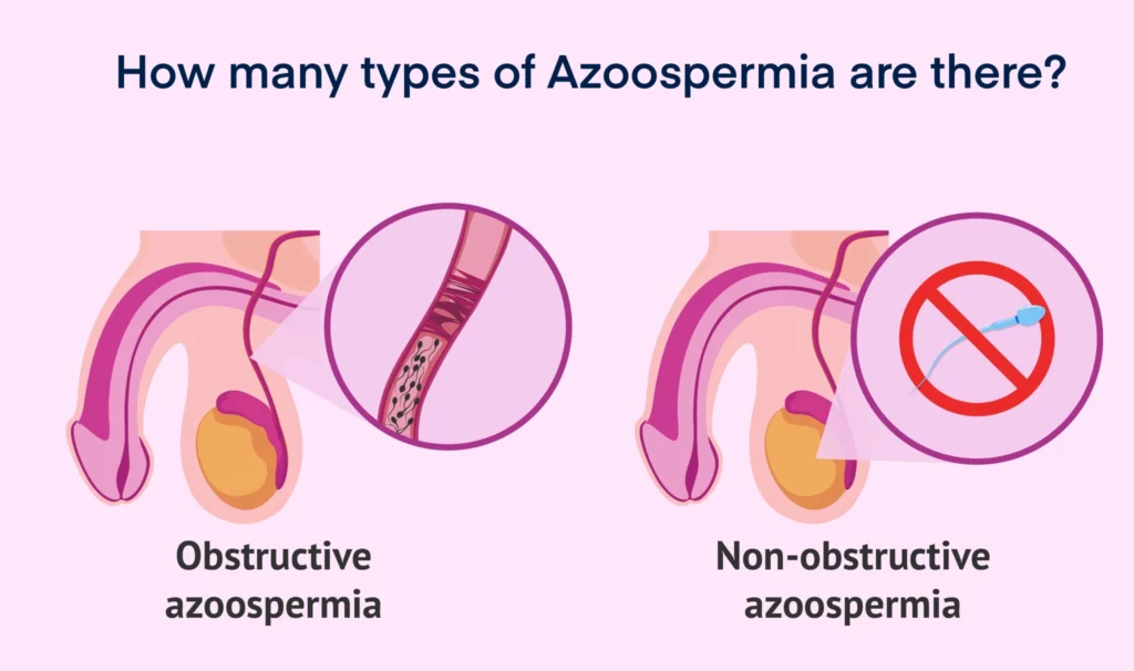 How many types of Azoospermia are there