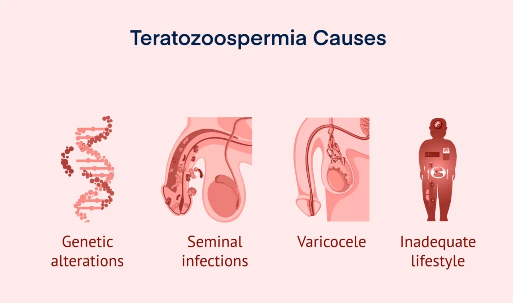 Teratozoospermia Causes
