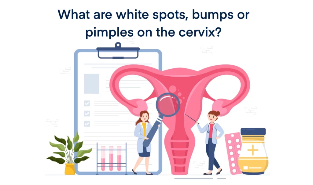What are white spots, bumps or pimples on the cervix