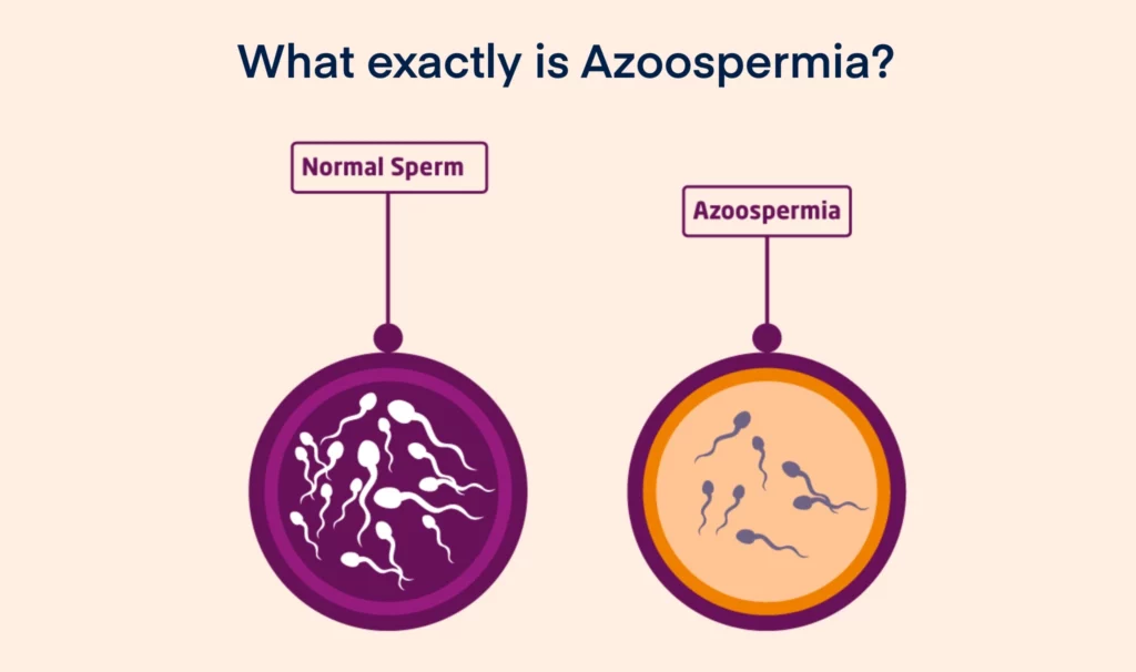What exactly is Azoospermia