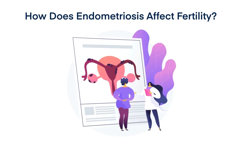 How Does Endometriosis Affect Fertility