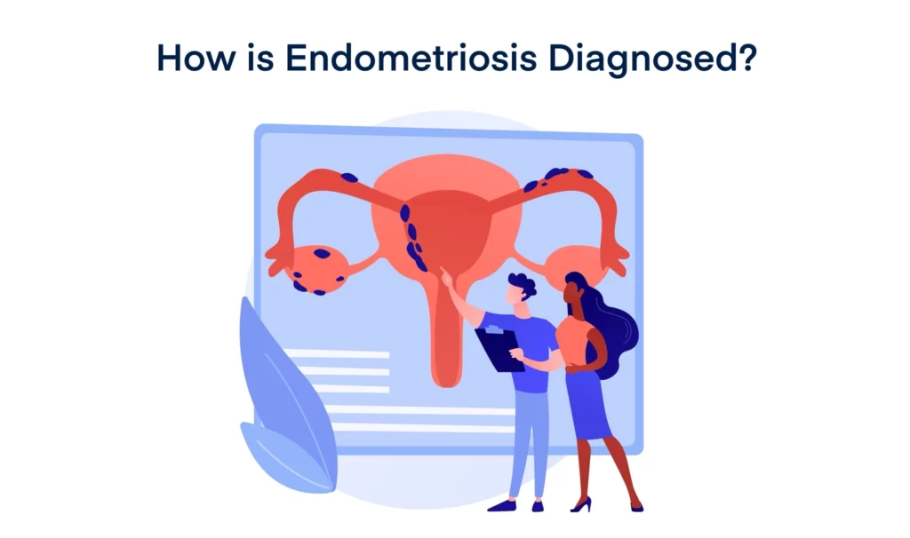 How is Endometriosis Diagnosed