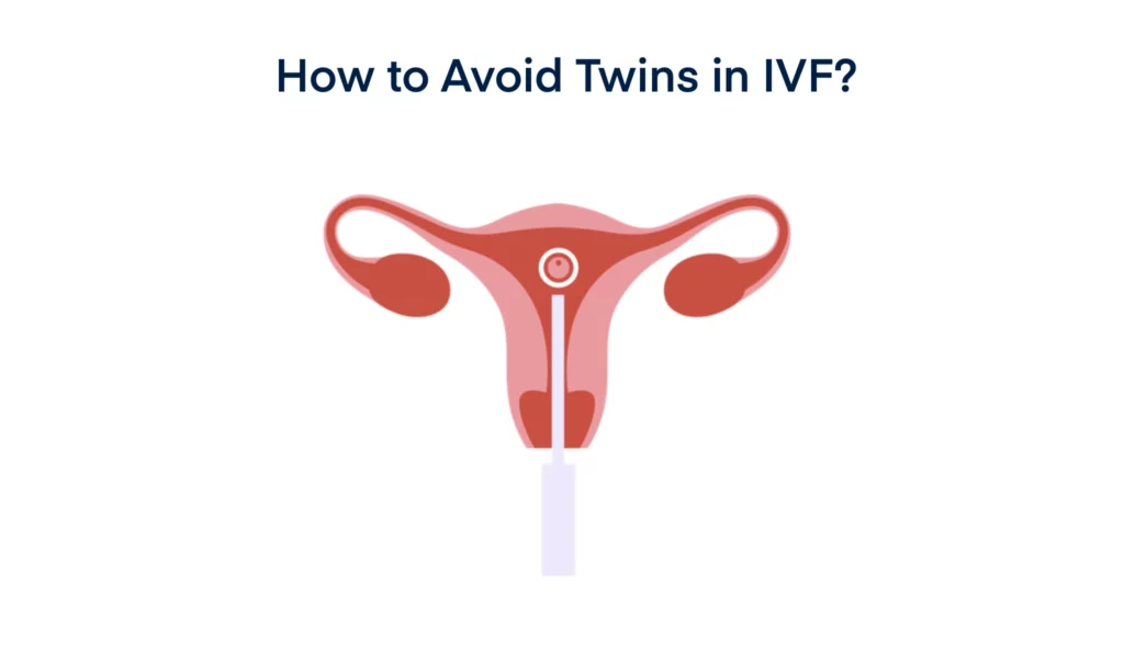 How to Avoid Twins in IVF