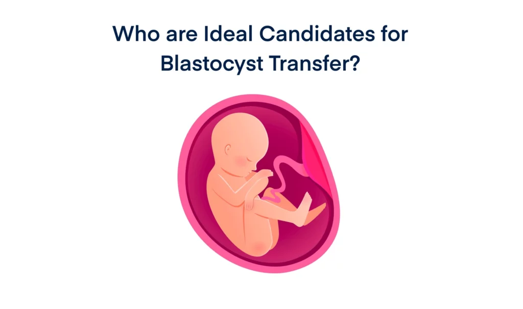 Who are Ideal Candidates for Blastocyst Transfer