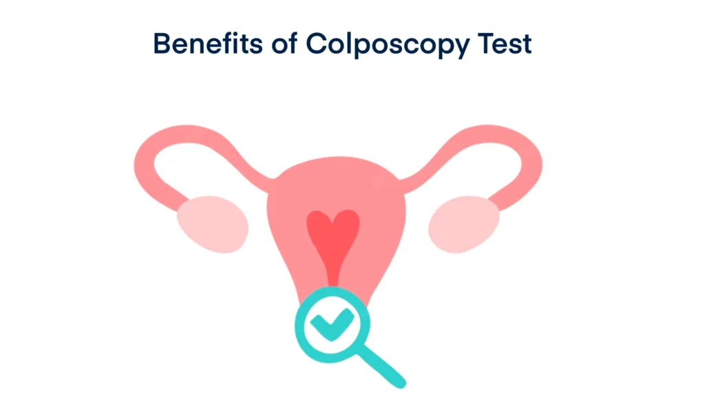 Benefits of Colposcopy Test