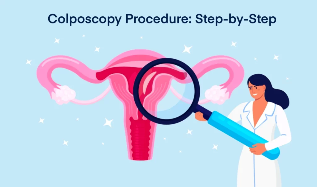 Colposcopy Procedure Step by Step