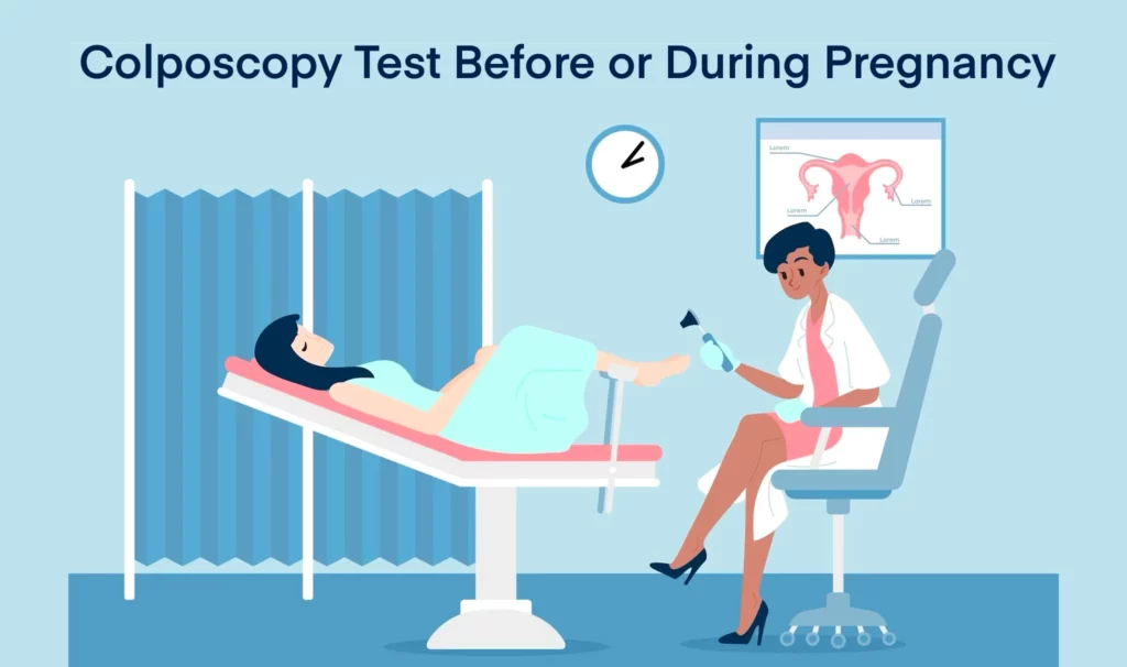 Colposcopy Test Before or During Pregnancy