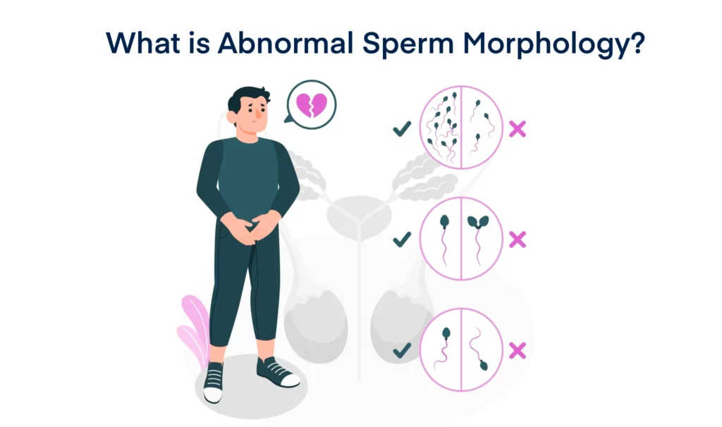 What is Abnormal Sperm Morphology