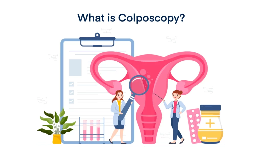 What is Colposcopy