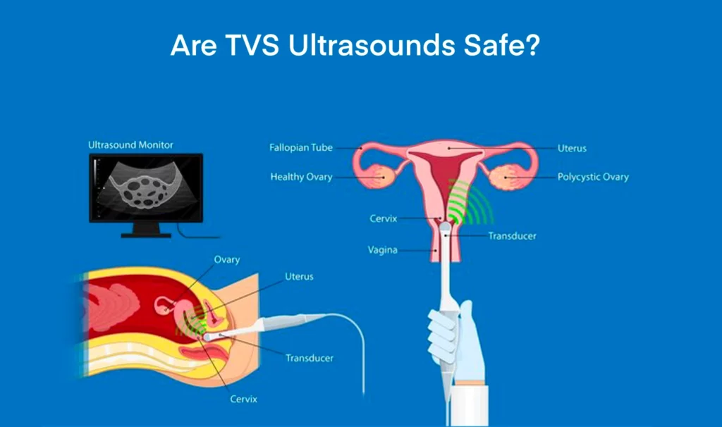 Are TVS Ultrasounds Safe