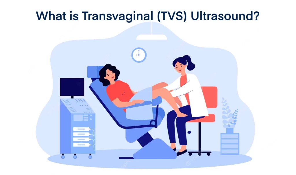 What is Transvaginal (TVS) Ultrasound