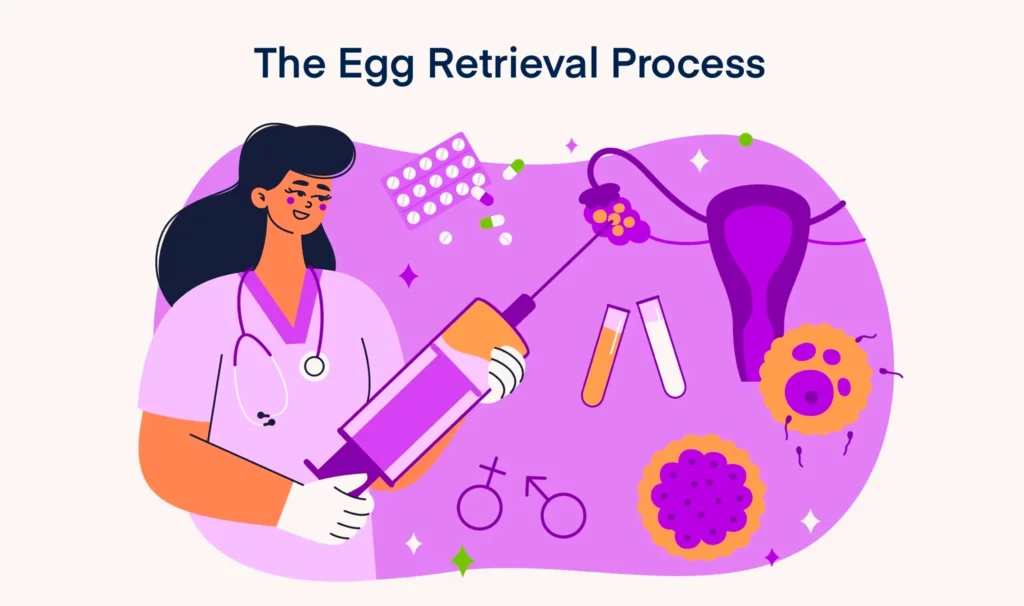 IVF Egg Retrieval Process