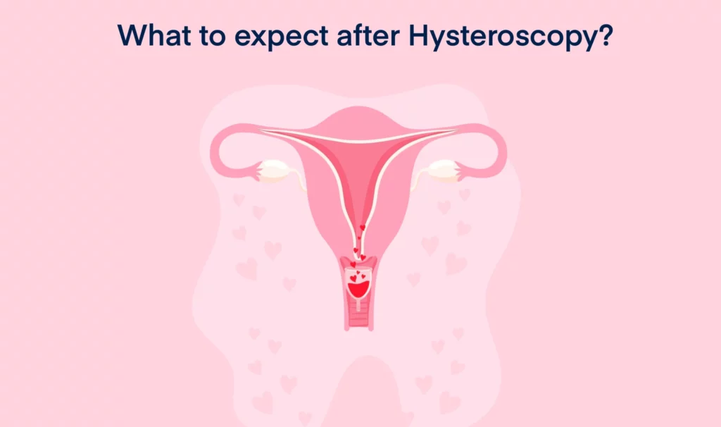 What to expect after Hysteroscopy